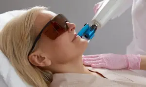 Regeneracja po laserze frakcyjnym: Przewodnik krok po kroku