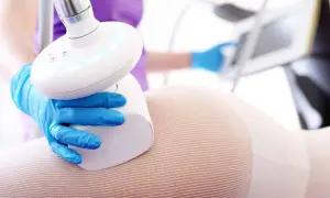 Endermologia: Co to? Skuteczny masaż podciśnieniowy na cellulit