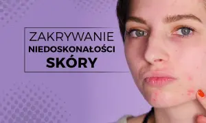 Niespodziewany pryszcz? Ukryj go makijażem i domowymi sposobami!