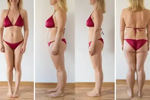Liposukcja: Czy jest bezpieczna? Ryzyko, metody i rekonwalescencja
