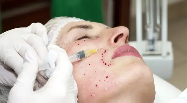 Mikrodermabrazja czy mezoterapia? Porównanie, efekty i ceny