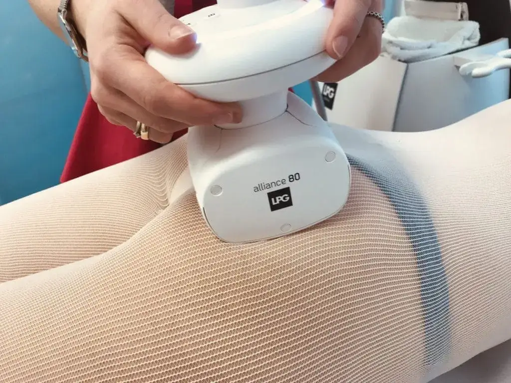 endermologia urządzenie lpg alliance