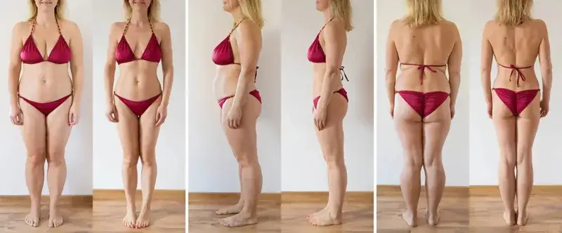 różne metody liposukcji porównanie