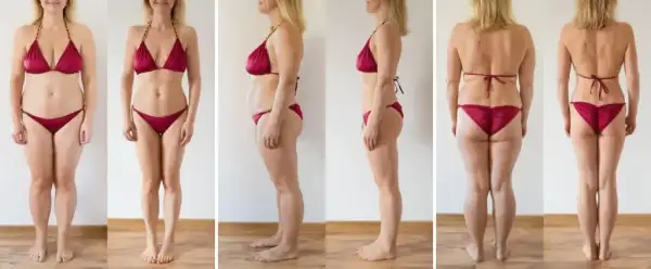 Liposukcja: Czy jest bezpieczna? Ryzyko, metody i rekonwalescencja