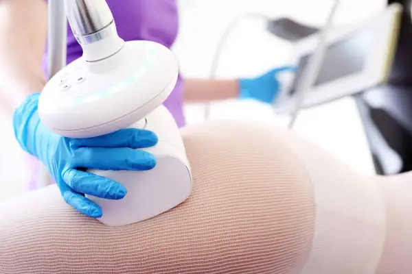 Endermologia: Co to? Skuteczny masaż podciśnieniowy na cellulit